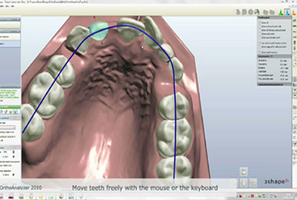什么是口腔义齿制造？口腔义齿制造是从事什么工作？插图3